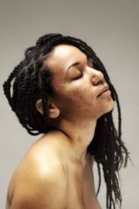 Серия портретов женщин с проблемной кожей и без макияжа