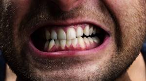 Почему зубы — это не кости?