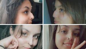 Снимки неидеальных, но уникальных женских носов