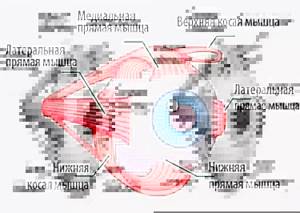 Что такое косоглазие и можно ли им заболеть?