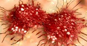 Ученые повысили устойчивость раковых клеток к препаратам — защитный механизм разгадан