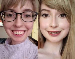 Примеры кардинального изменения внешности на снимках до и после